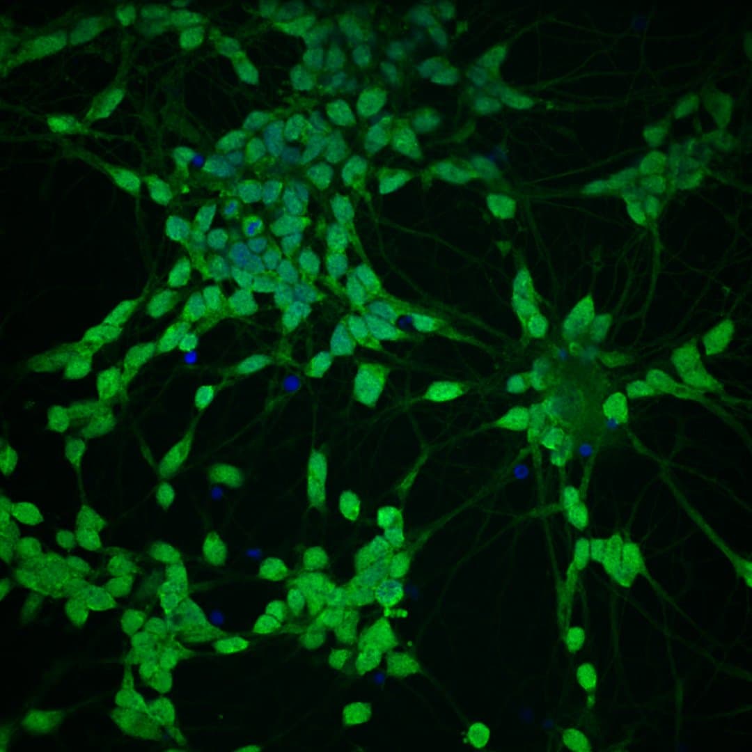 Human motor neurons viewed with spinning-disk confocal microscopy